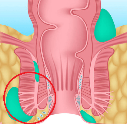 Anal Apse
